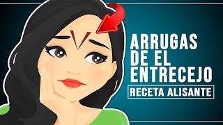 ARRUGAS DE EL ENTRECEJO [upl. by Egwin]