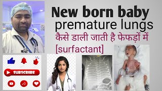 New born premature baby 👶care unit ♥️ lungs me surfactant kare डालते hai [upl. by Sela]