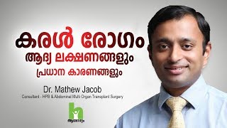 കരൾ രോഗത്തിന്റെ ഈ ലക്ഷണങ്ങൾ സൂക്ഷിക്കുക  Liver Disease Malayalam Health Tips [upl. by Ettezel]