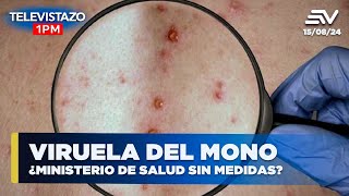 Viruela del mono ¿Ministerio de salud sin medidas  Televistazo 1PM ENVIVO🔴 [upl. by Pritchett856]