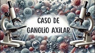 Caso citológico de ganglio axilar [upl. by Hippel142]