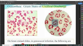 11 Gram ve cocci Neisseria lecture 11 microbiology [upl. by Kung3]