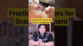 Laser Treatments for Face  Pimples and Acne Scar Laser Treatments laser resurfacing shorts [upl. by Deeraf]