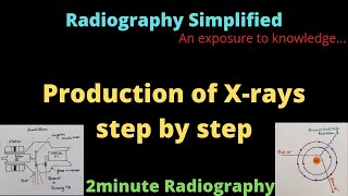 Production of Xrays l 2minute Radiography l Radiography Simplified l [upl. by Trefor]