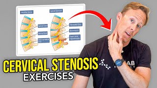 5 Exercises for Cervical Stenosis Arm Nerve Pain [upl. by Harman14]