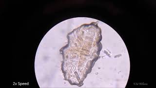 Tardigrade forming a Tun  Part 1 [upl. by England]