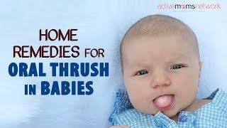 Home Remedies For Oral Thrush In Babies [upl. by Enitsrik]