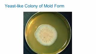 Dimorphic Fungi Sporothrichosis Hot Topic [upl. by Ecirahs]