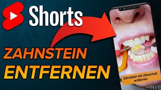 Zahnstein entfernen Unterkiefer shorts [upl. by Yendyc]