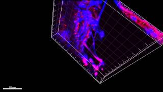 Example of 3D modeling of tumor to visualize tunneling nanotubes connecting cells in human tumors [upl. by Sirtaeb966]