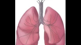 BREATH SOUNDS Stages of Fluid Overload Pneumonia [upl. by Vandyke457]