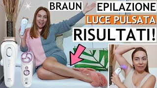 COME USARE BRAUN SILK EXPERT LUCE PULSATA A CASATRATTAMENTO VISOCORPO X ELIMINARE I PELIRISULTATI [upl. by Adnema382]