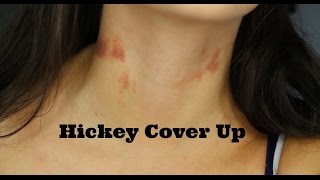 How To Cover up hickeys [upl. by Otilegna]