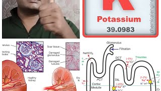 Diuretic TypesMechanismNephronKidneyBangali Doctorclinical Pharmacologist [upl. by Eiramyllek]