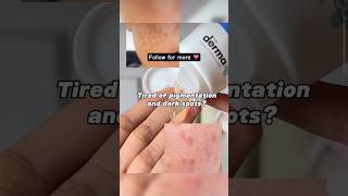 Derma co face wash pigmentation dark spot treatment skincare acnetreatment skincareroutine [upl. by Annoel]