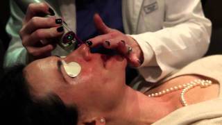 Laser treatment for Rosacea Birmingham Alabama  Cosmetic Dermatology [upl. by Artenra436]