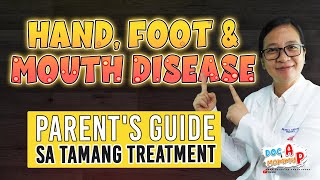 HAND FOOT and MOUTH DISEASE  Parents Guide sa Tamang Gamutan  Doc A Pediatrician [upl. by Geiss]