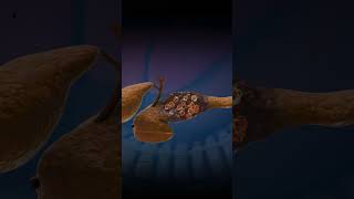 3D Animation of Pancreas Damage Medical Animation [upl. by Lipfert]