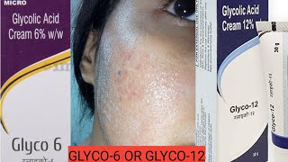 Glycolic Acid Cream 6 vs Glycolic Acid 12  How to Use Glycolic acid cream [upl. by Nnylaehs609]