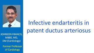 Infective endarteritis in patent ductus arteriosus [upl. by Takken496]