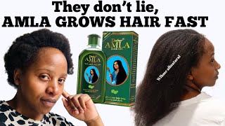 AMLA OIL Amla oil for hair growthhow to make Amla oil for hair growth Diy amla oil for hair [upl. by Chrisoula582]