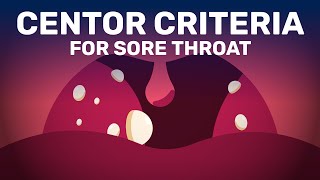 Is Your Sore Throat Caused by Bacterial Infection or Viral [upl. by Ainahpets675]