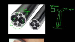 How Does an Endoscope Work  GCSE Physics [upl. by Cindy]