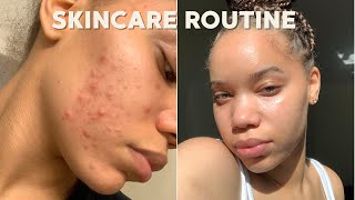 SKINCARE ROUTINE that works ACNE PRONE SKIN  Kaila Kake [upl. by Knowland946]