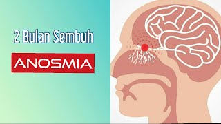 2 BULAN ANOSMIA SEMBUH [upl. by Zenda]