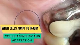 Cellular Injury and Adaptation [upl. by Nitsua]