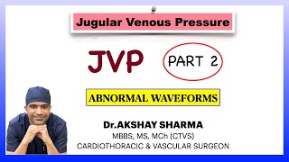 JUGULAR VENOUS PRESSURE JVP PART 2 ABNORMAL WAVEFORM  for NEETPG USMLE FMGE [upl. by Janessa]