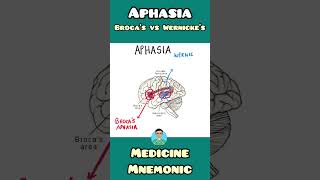 Brocas Aphasia VS Wernickes Aphasia  mnemonic  shorts [upl. by Bora790]