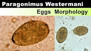 Paragonimus Westermani Eggs Morphology [upl. by Ennaej775]