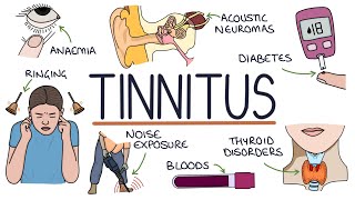 Understanding the Causes of Tinnitus [upl. by Lauren762]