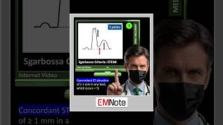 Sgarbossa Criteria of STEMI [upl. by Eiramave]