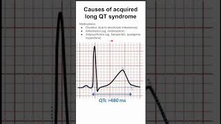 Causes of acquired long QT syndrome [upl. by Amoreta]