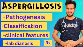 Aspergillosis microbiologymorphologypathogenesislabdiagnosisTreatment [upl. by Isidoro357]