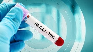 What is the Optimal HbA1c Target for Type 2 Diabetes Patients [upl. by Aroon870]