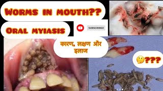 Worms in mouthoral myiasishow to treatsignampsymptomscausesoral hygieneworms infectionMyiasis [upl. by Martinic]