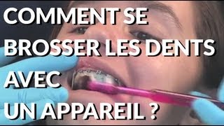 Comment se brosser les dents avec un appareil dentaire  Appareildentaireinfo [upl. by Rma]