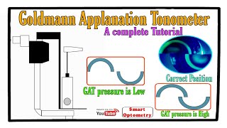 Goldmann Applanation Tonometer  Complete Tutorial [upl. by Elleval812]