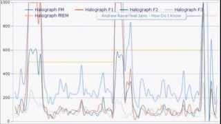 Effects of Choline and Galantamine on Eye Movements During Sleep [upl. by Oirom]