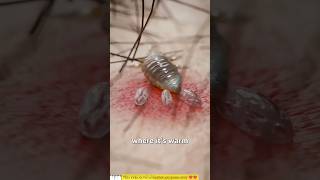 How Lice Survive On Your Scalp 😳 [upl. by Camilla]