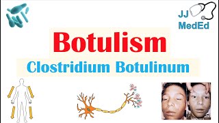 Botulism Clostridium Botulinum Pathogenesis Symptoms Diagnosis Treatment Prevention [upl. by Sagerman]