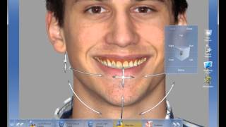 Enhance Smiles Seamlessly CEREC Software 42 Smile Design [upl. by Olva]