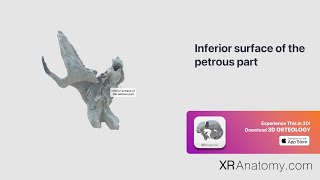 Temporal Bone Inferior surface of petrous part [upl. by Etaner923]