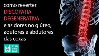 Como reverter discopatia degenerativa e as dores no glúteo adutores e abdutores das coxas [upl. by Leamaj]