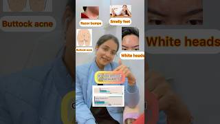 One solution for all these problems drmallika telugudoctorsvideos benzoylperoxide beauty [upl. by Ayit]