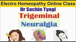 Trigeminal neuralgia and PID Electro Homeopathic Treatment  BEMS Online classes  DEMS [upl. by Seraphine879]