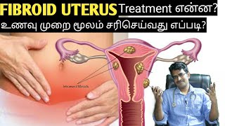 Fibroid uterus causesampdiet explanation in tamilmedical awareness in tamil [upl. by Viglione]